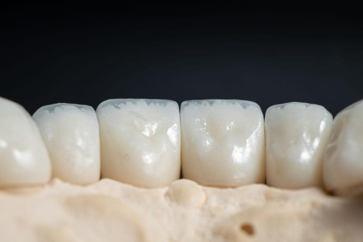 Zirconium Crowns