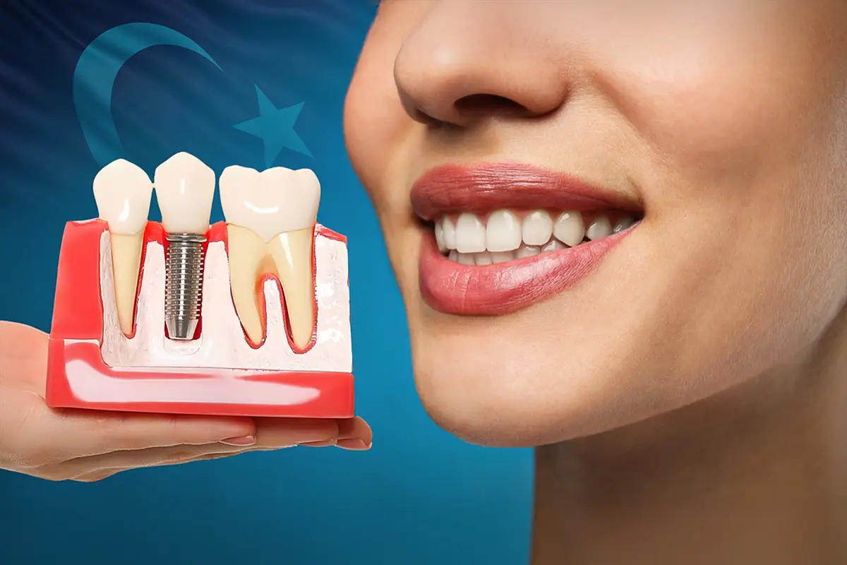 Dental Implant Turkey