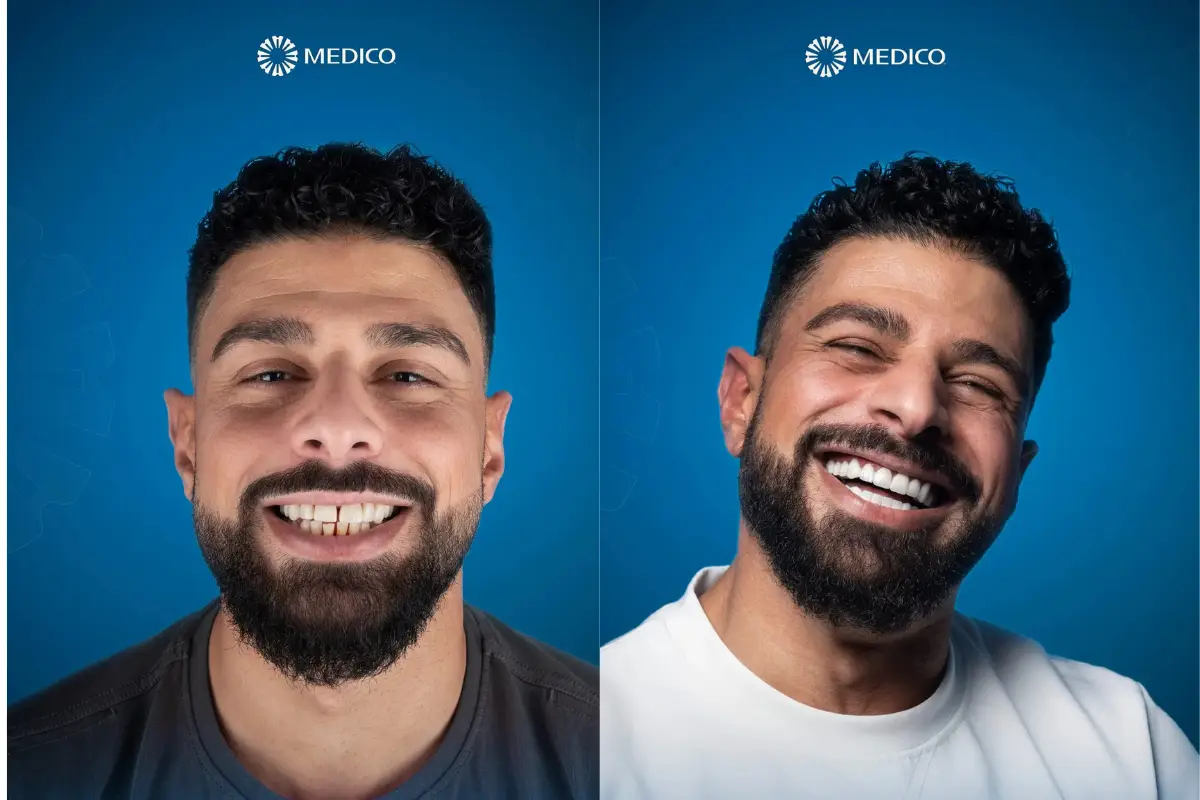 dental plan
