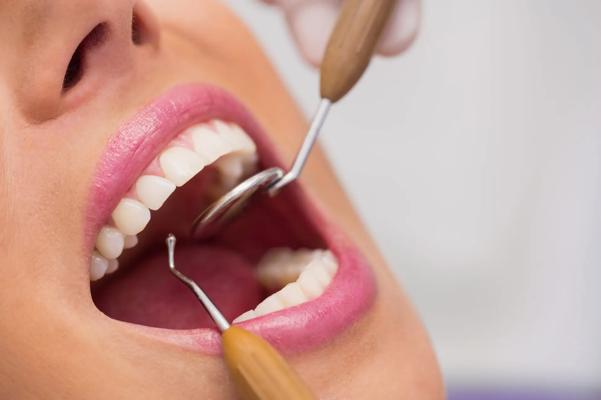 Composite Teeth