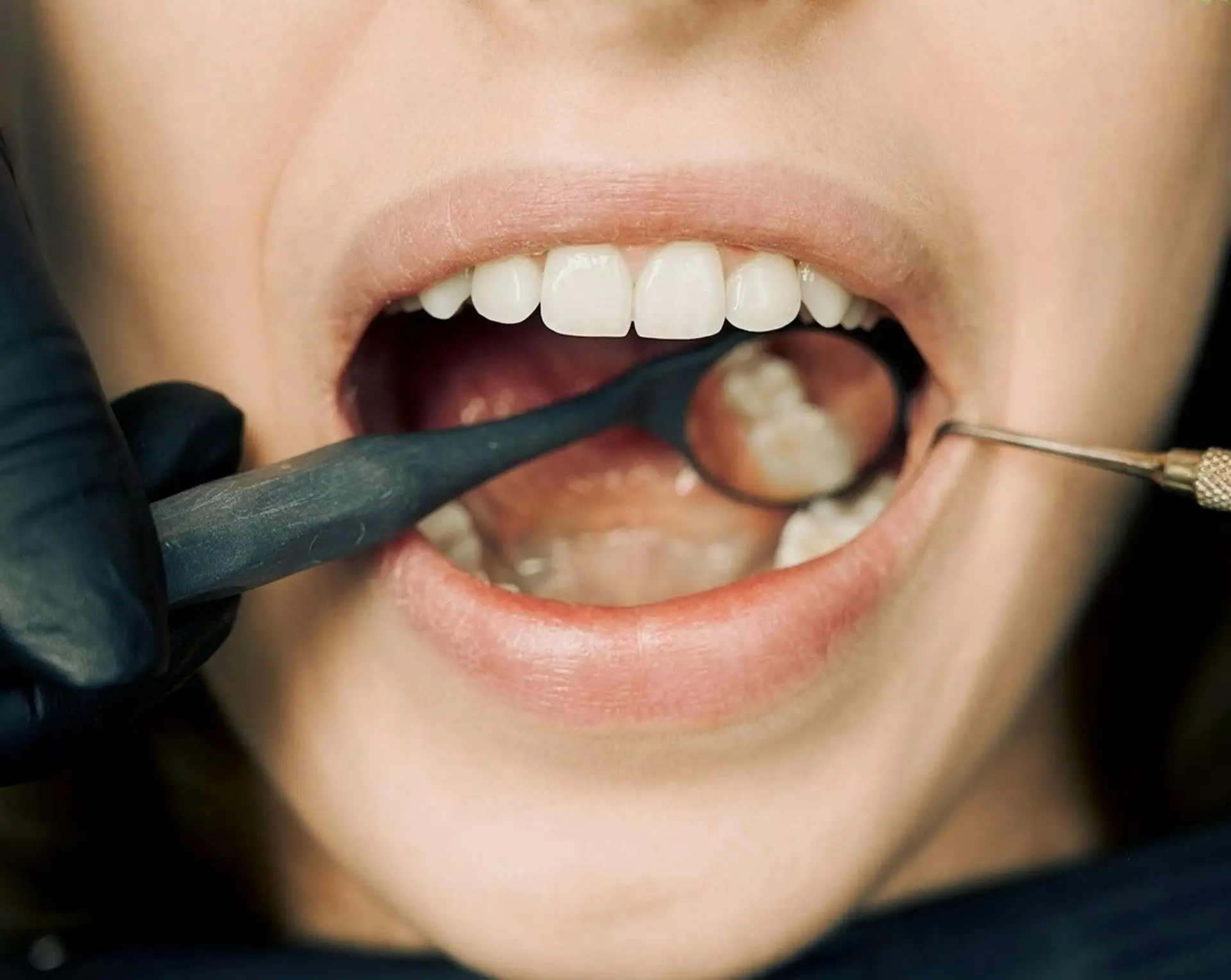 Zirconia or Natural Teeth